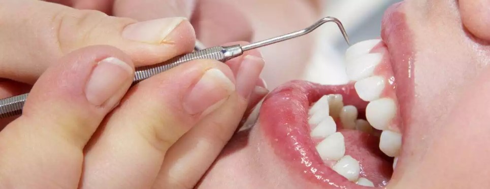 teeth-cleaning-astoria